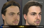 game/FIFA 2015/_thb_fifa15_037.jpg